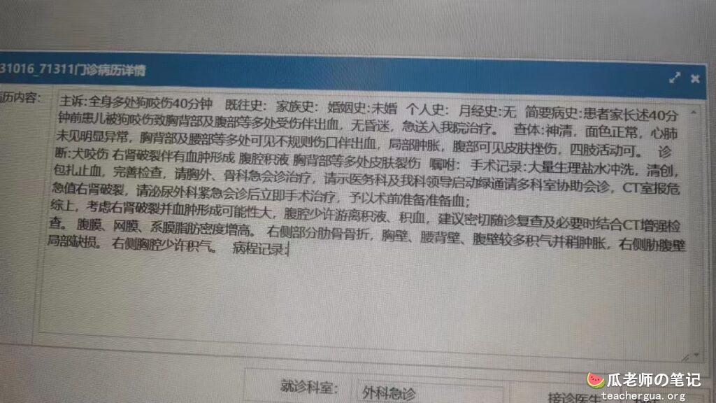 成都崇州恒大西辰绿洲封闭小区发生恶性事件大型犬只发狂咬人导致小区居民受伤与一名小孩重伤